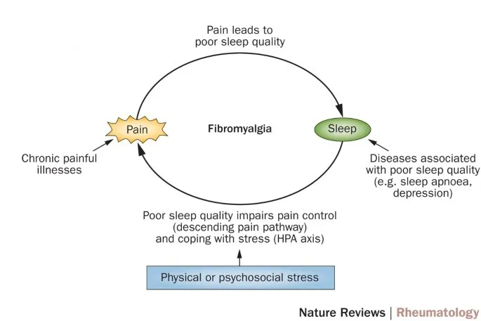 Fibromyalgia Sleep Loop